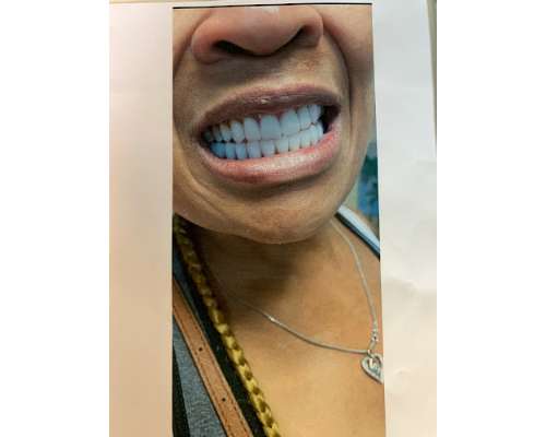 Imagen no disponible