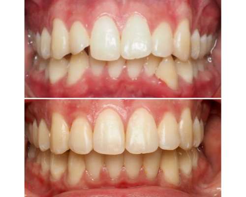 Imagen no disponible