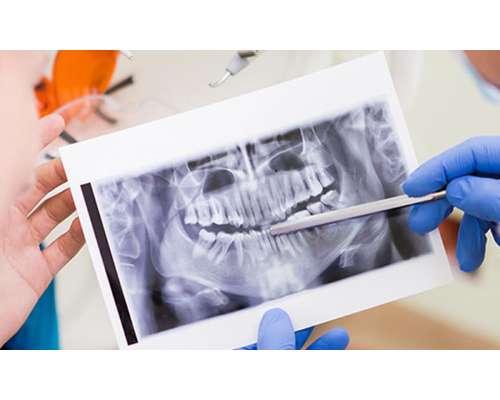 Imagen no disponible