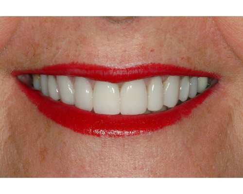 Imagen no disponible