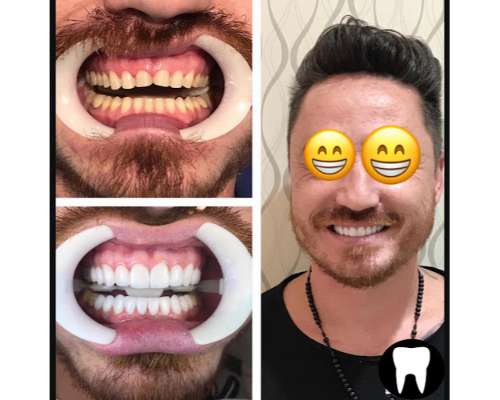 Imagen no disponible