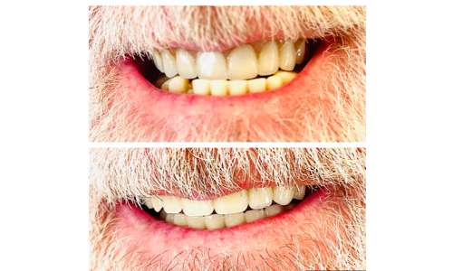 Imagen no disponible